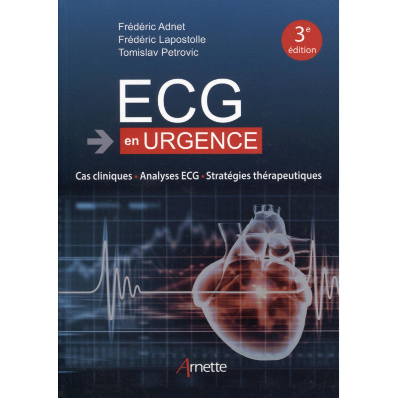 ECG en urgence: Cas cliniques - Analyses ECG - Stratégies thérapeutiques