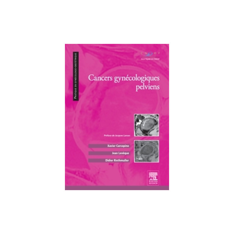 Cancers gynécologiques pelviens - Librairie de France