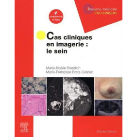Cas cliniques en imagerie : le sein